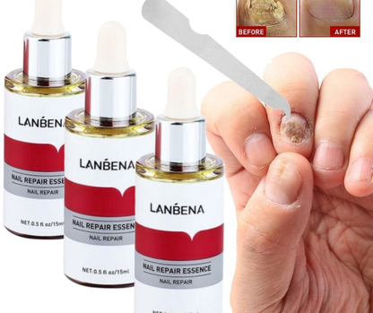 LANBENA NAIL REPAIR ESSENCE