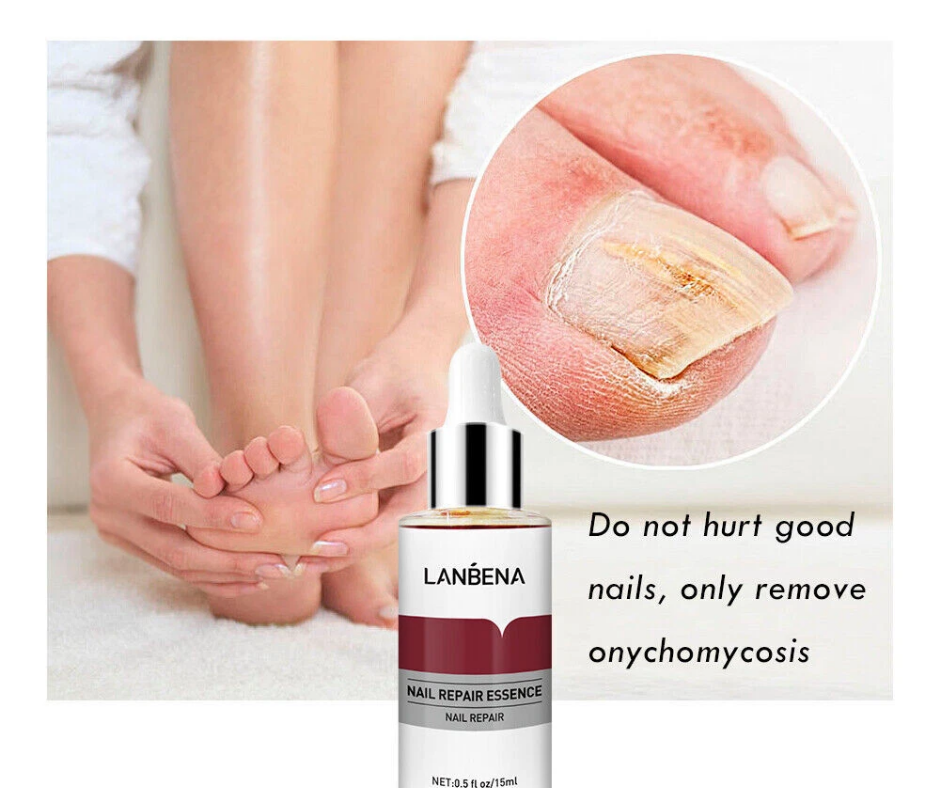LANBENA NAIL REPAIR ESSENCE