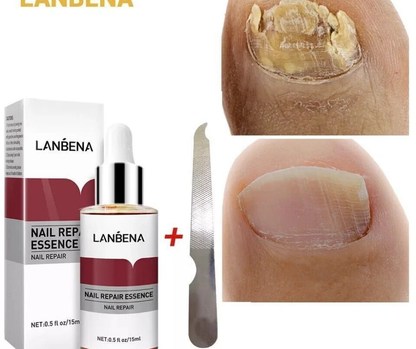 LANBENA NAIL REPAIR ESSENCE